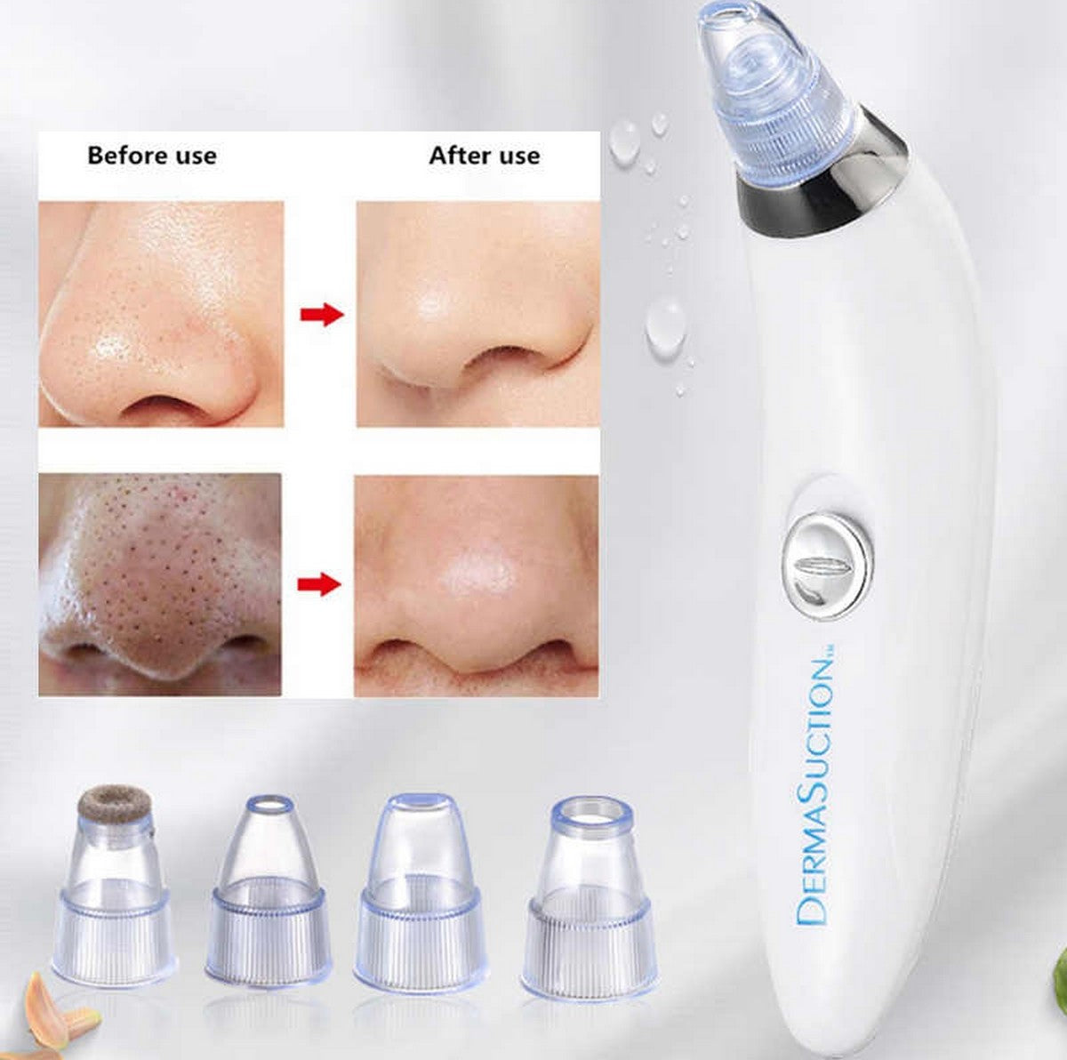 Electric Pore Vacuum Cleaner – Facial Blackhead & Skin Cleaning Device with 4 Interchangeable Heads