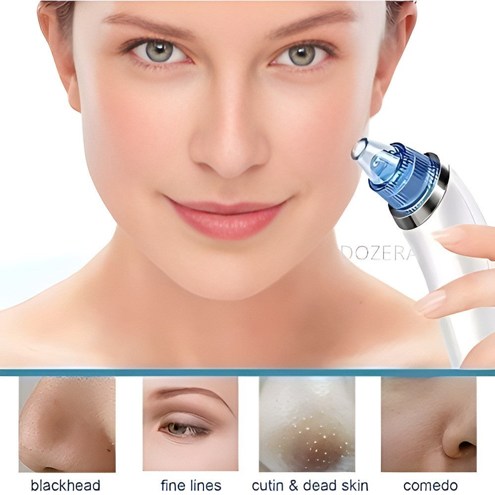Electric Pore Vacuum Cleaner – Facial Blackhead & Skin Cleaning Device with 4 Interchangeable Heads