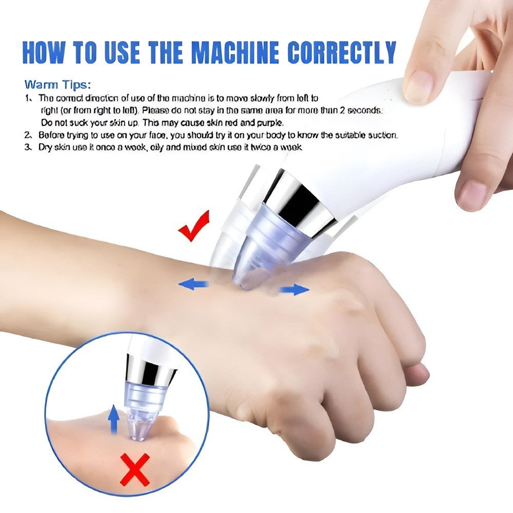 Electric Pore Vacuum Cleaner – Facial Blackhead & Skin Cleaning Device with 4 Interchangeable Heads