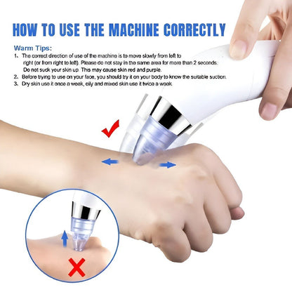 Electric Pore Vacuum Cleaner – Facial Blackhead & Skin Cleaning Device with 4 Interchangeable Heads