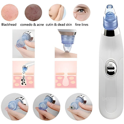Electric Pore Vacuum Cleaner – Facial Blackhead & Skin Cleaning Device with 4 Interchangeable Heads