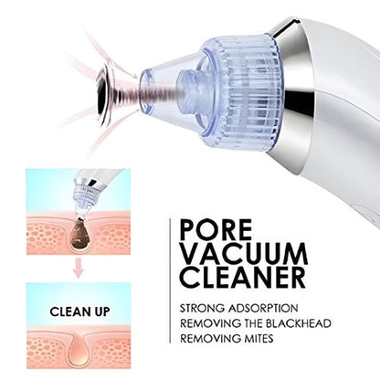 Electric Pore Vacuum Cleaner – Facial Blackhead & Skin Cleaning Device with 4 Interchangeable Heads